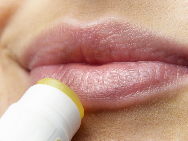 HERPES LABIALE: COME GESTIRE UN'INFEZIONE FASTIDIOSA